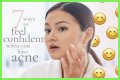 How To Feel Confident With Acne?
