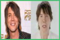 John Rzeznik Facelift | Goo Goo Dolls Frontman Plastic Surgery Before And After